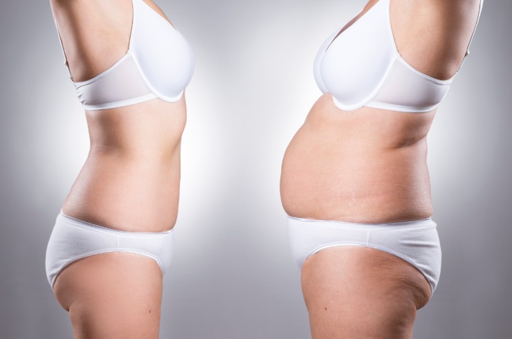 Risultato prima e dopo dieta